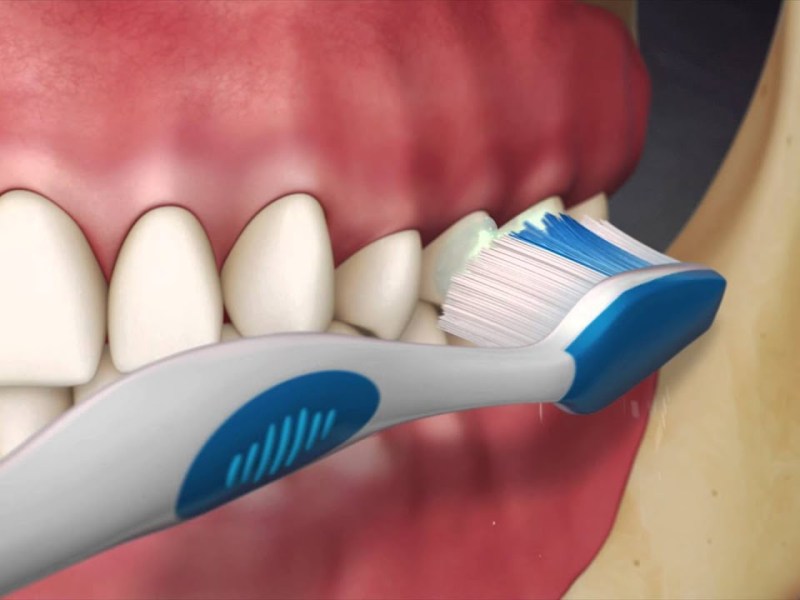 In-Depth Cleaning Brushing&nbsp;Technique